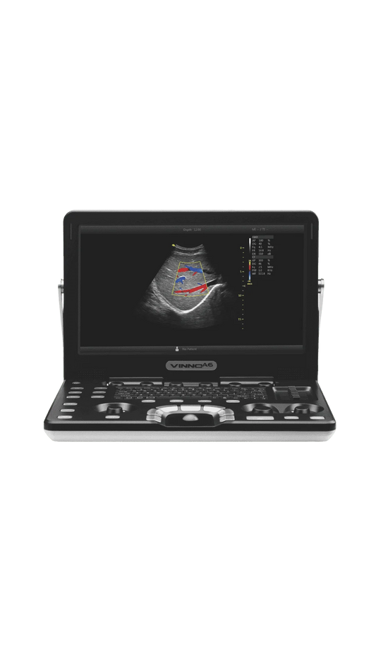 Ecógrafo Portátil VINNO A6