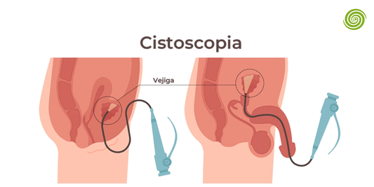 Cistoscopio