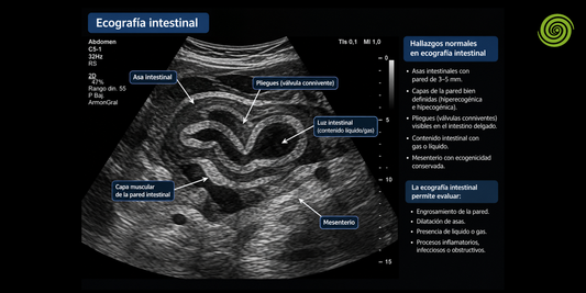 Ecografía intestinal diagnóstica