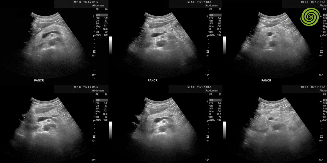 Ecografías Abdominales