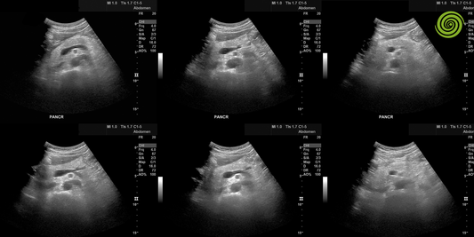 Ecografías Abdominales