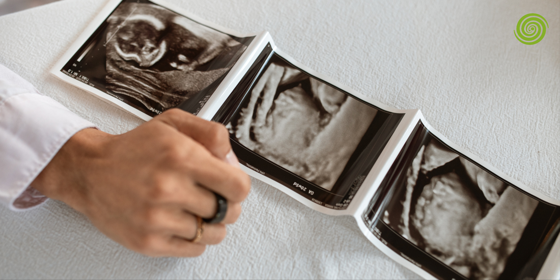 Embarazo extrauterino