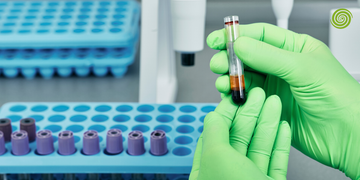 Equipos de Bioquímica Clínica