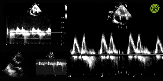 Principios de la ecografía