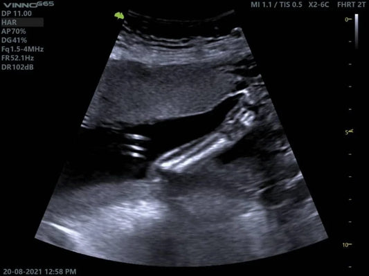 Ultrasonido Abdominal