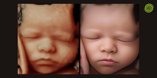ecografía