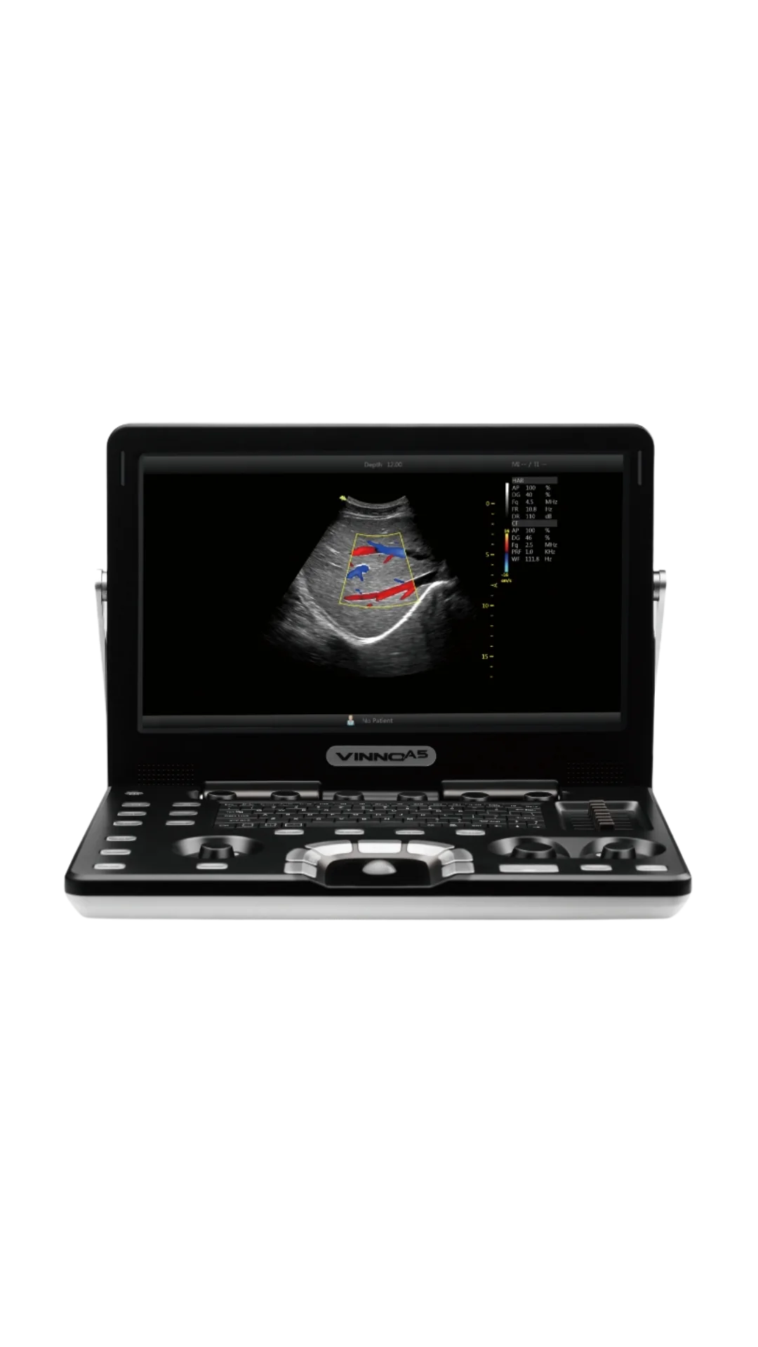 Ecógrafo Portátil VINNO A5