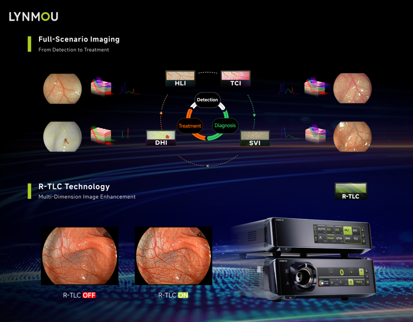 Sistema de Endoscopia LYNMOU VC-1600 Series