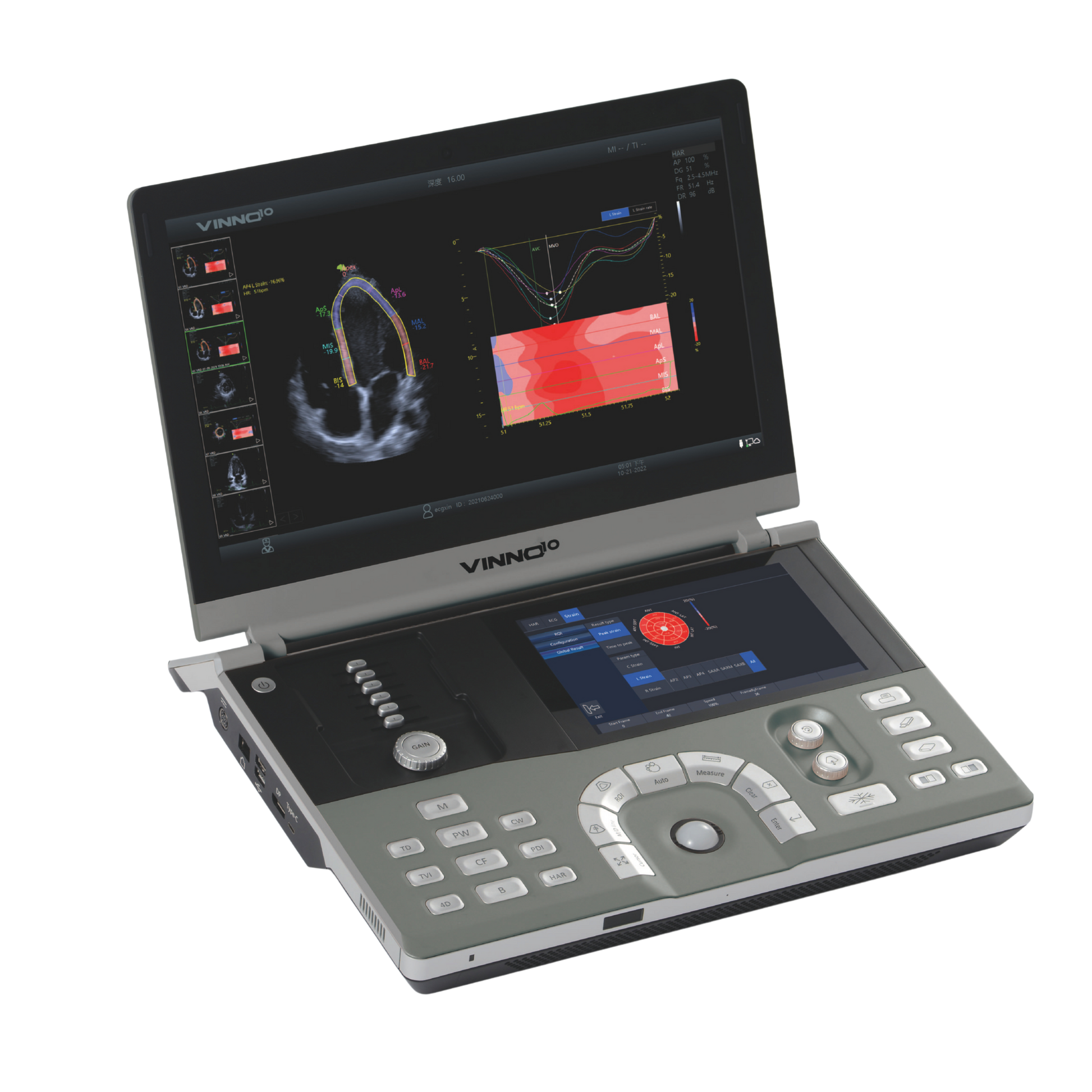 Ecógrafo Portátil VINNO 10 VINNO