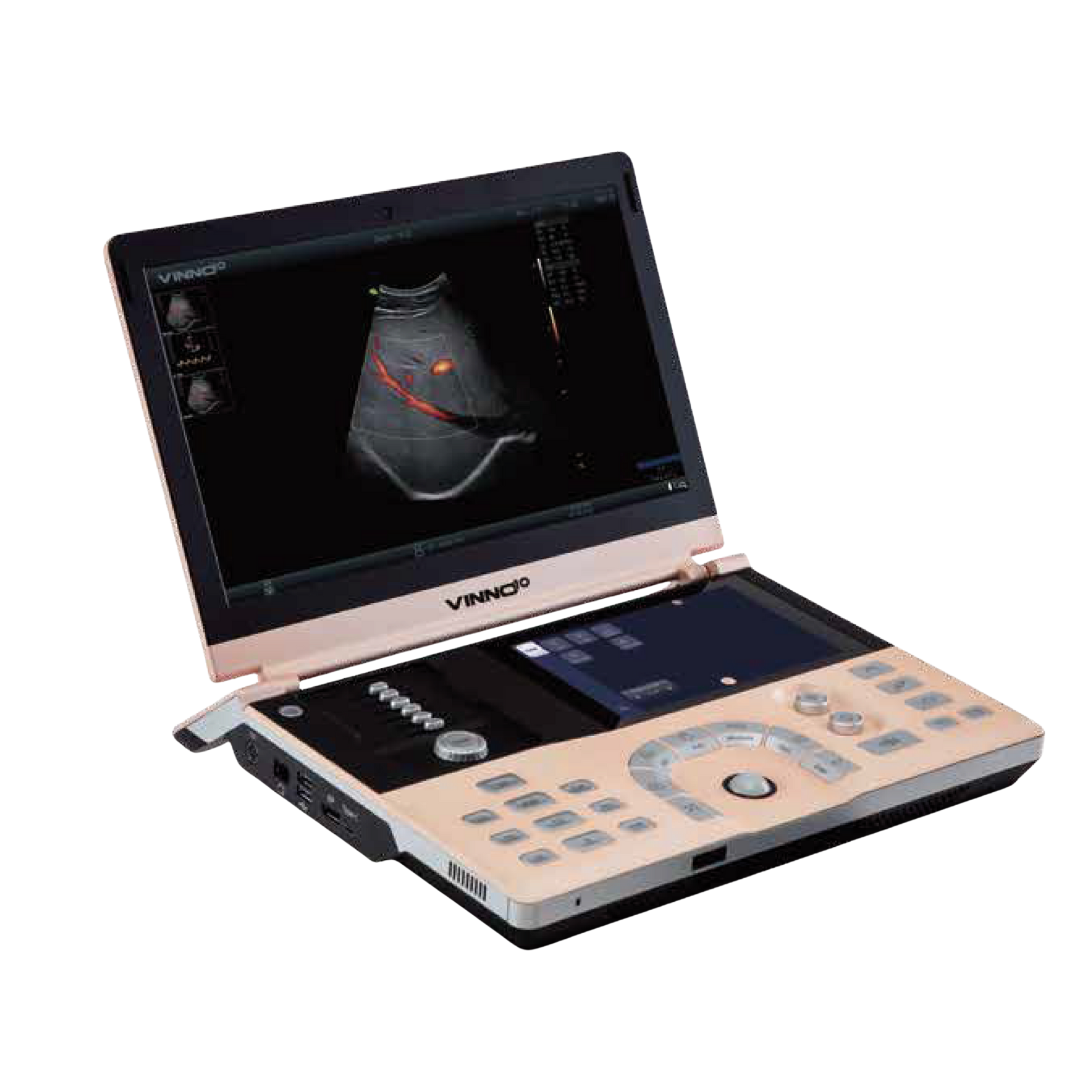 Ecógrafo Portátil VINNO 10 VINNO