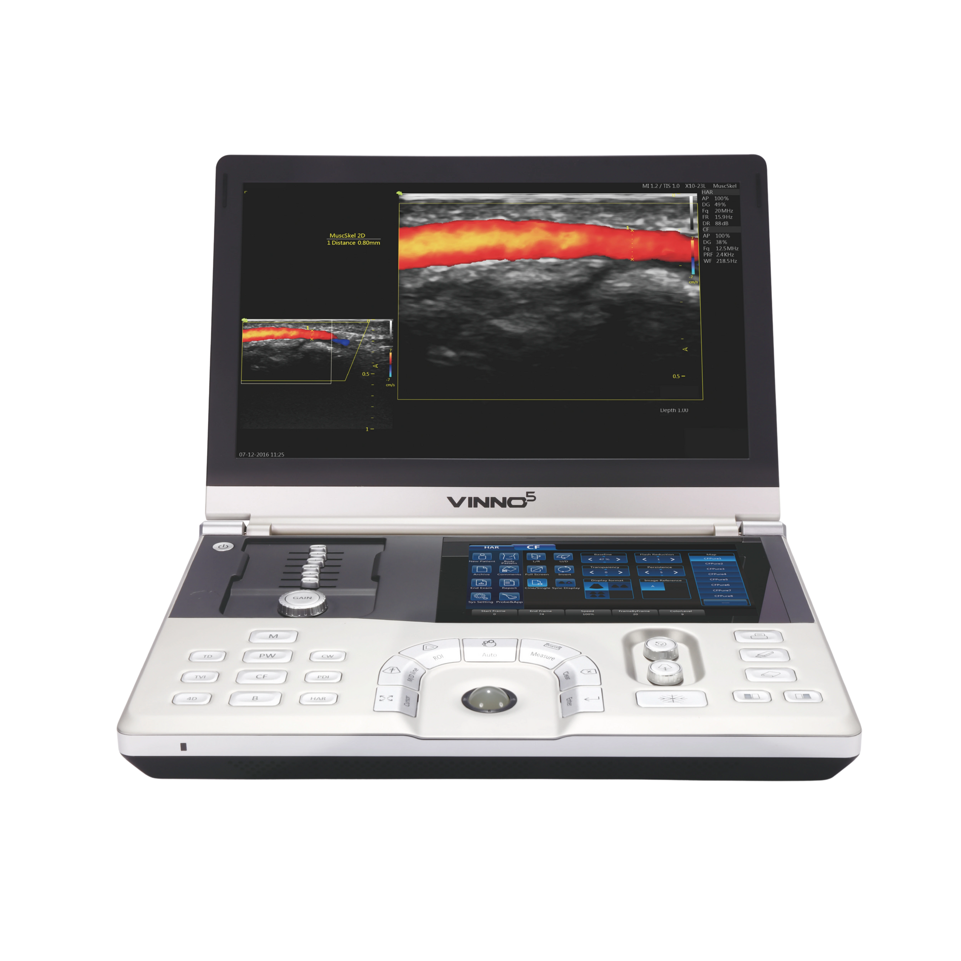 Ecógrafo Portátil VINNO 5 VINNO