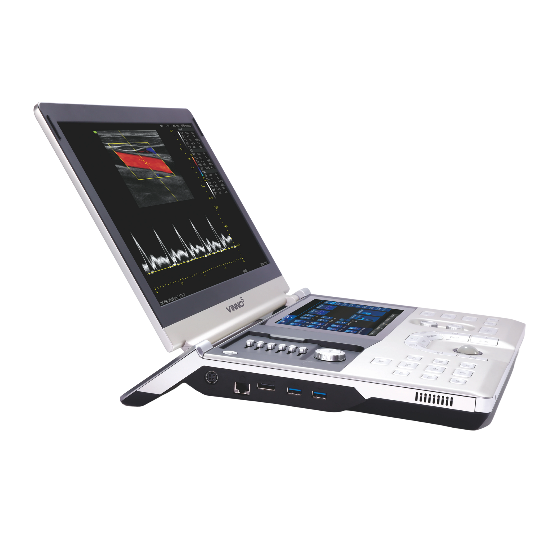 Ecógrafo Portátil VINNO 5 VINNO