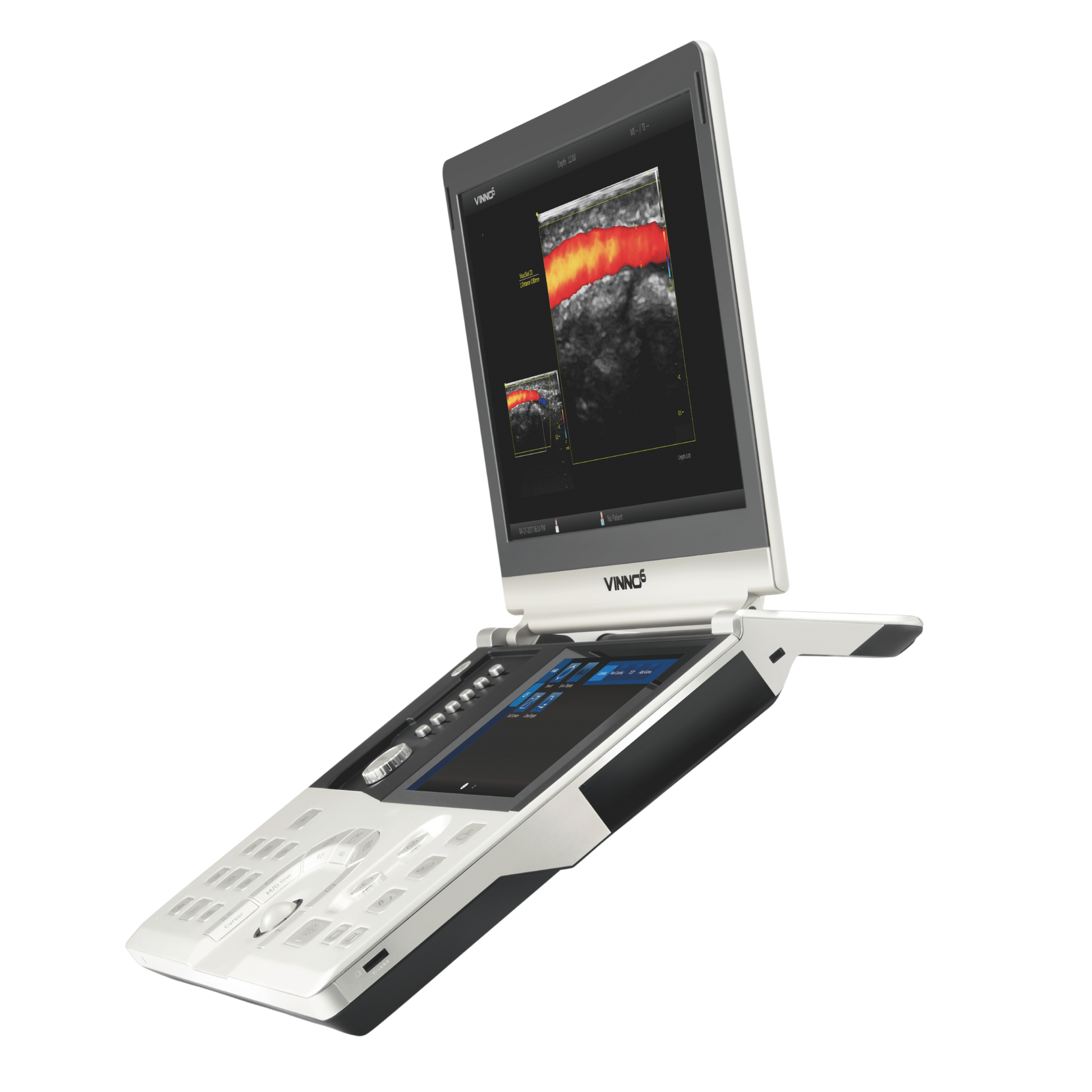 Ecógrafo Portátil VINNO 6 VINNO