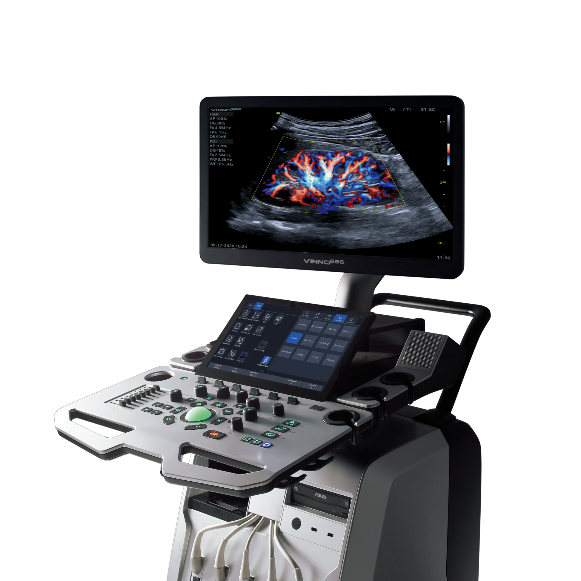 Ecógrafo VINNO G86 VINNO
