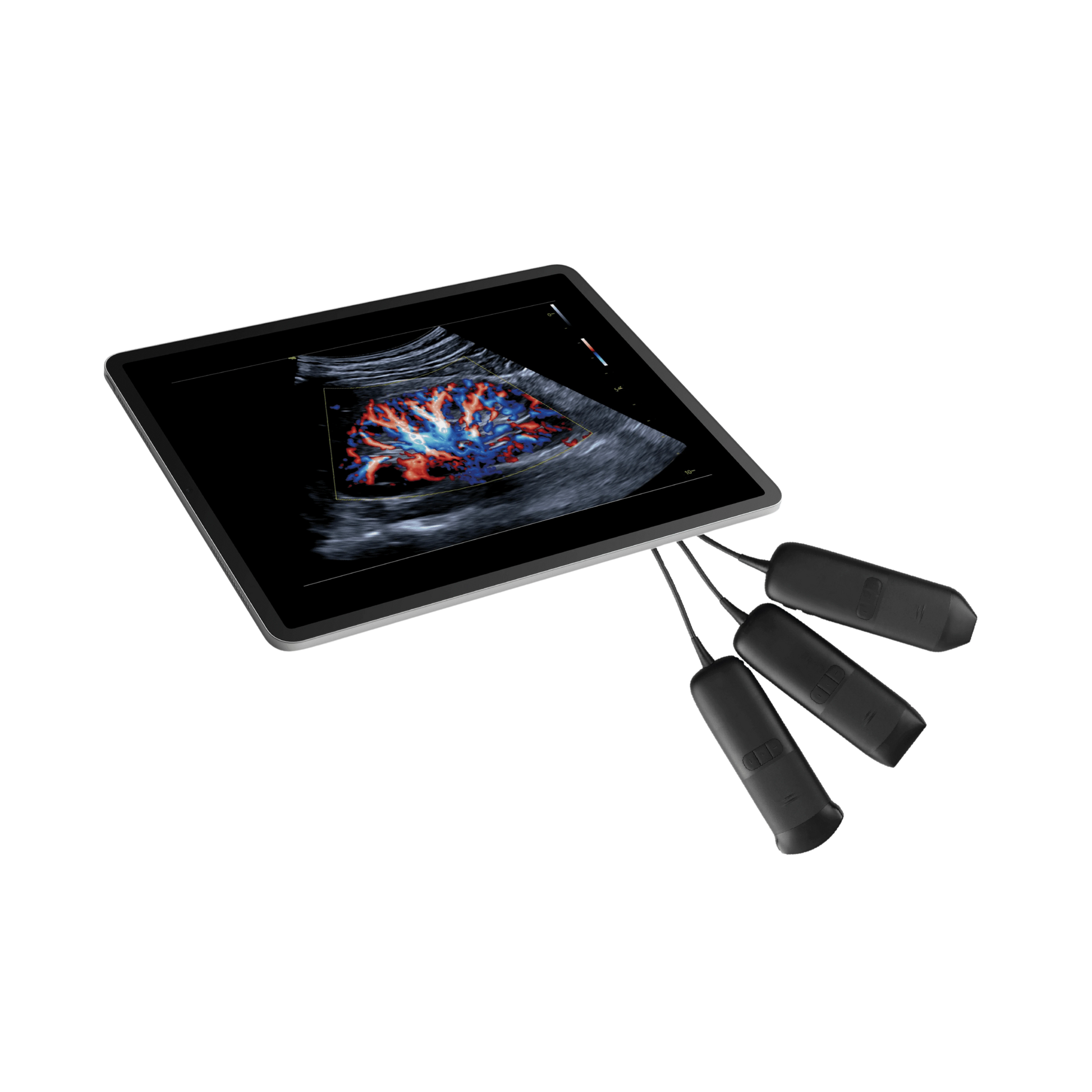 Ecógrafo Ultraportátil VINNO Q+