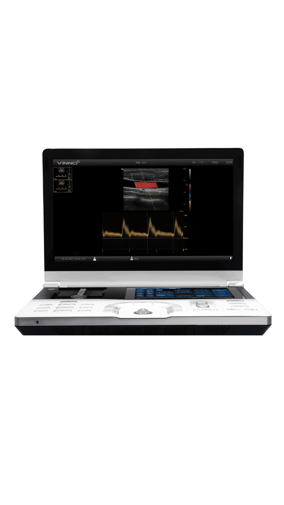 Ecógrafo Portátil VINNO 5