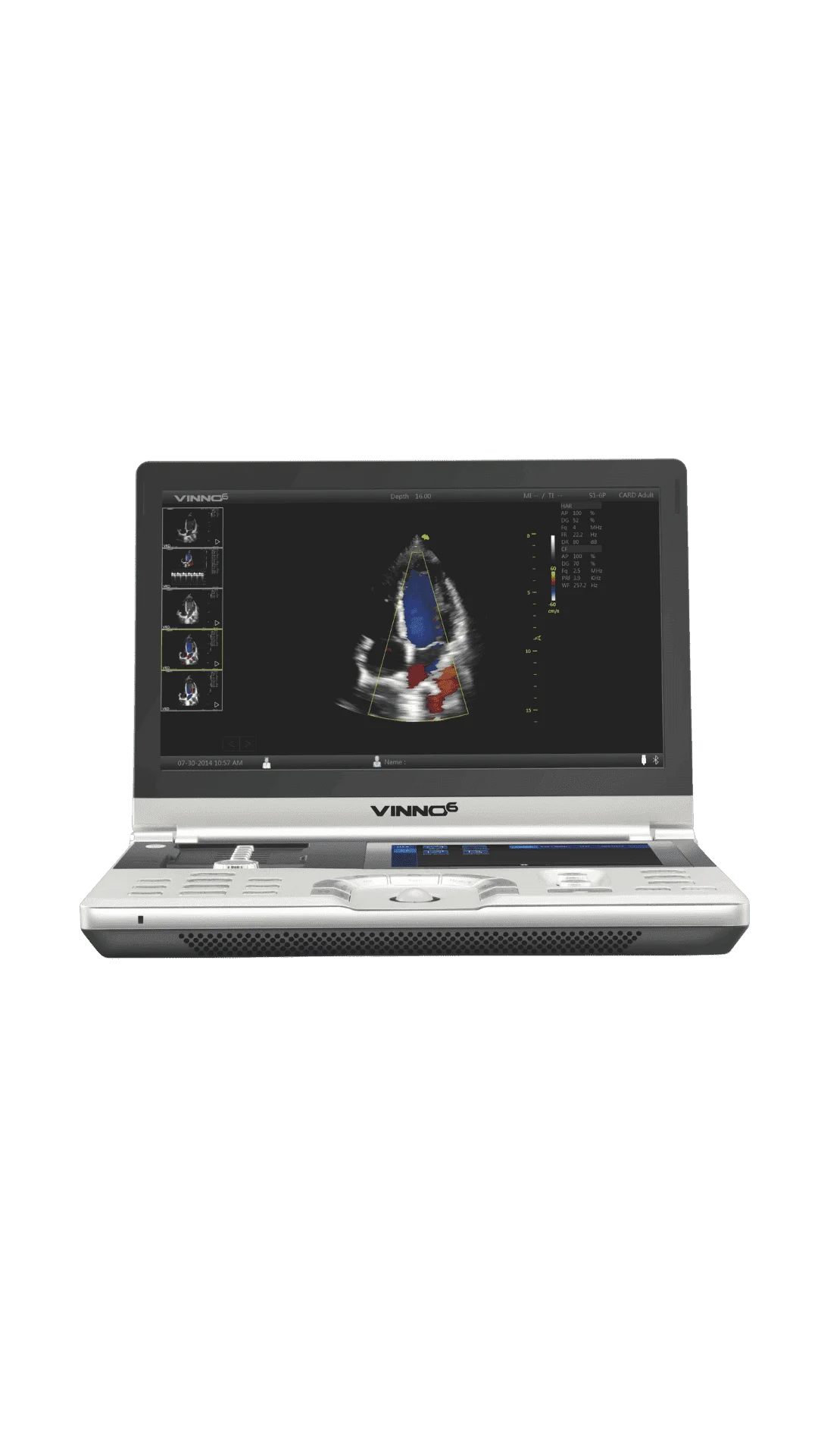 Ecógrafo Portátil VINNO 6