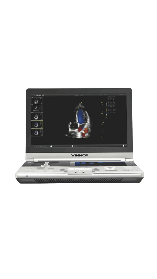 Ecógrafo Portátil VINNO 6