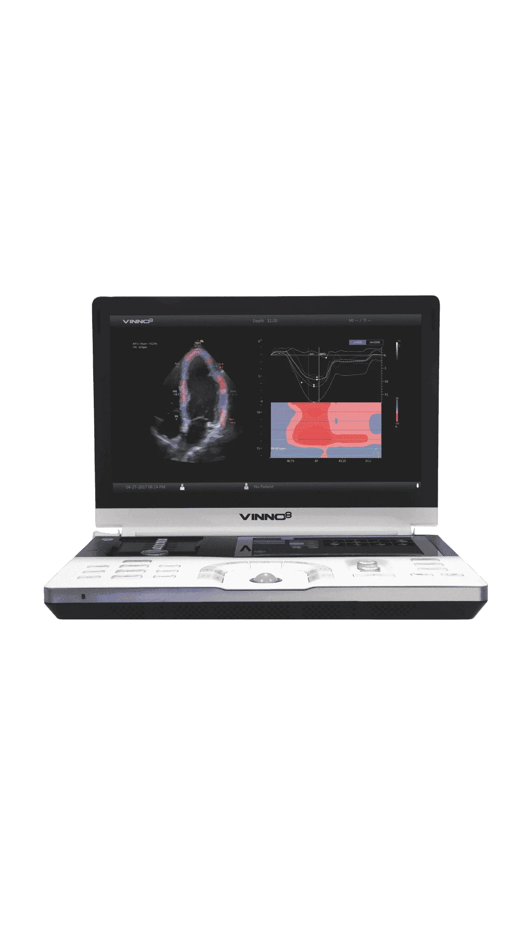 Ecógrafo Portátil VINNO 8