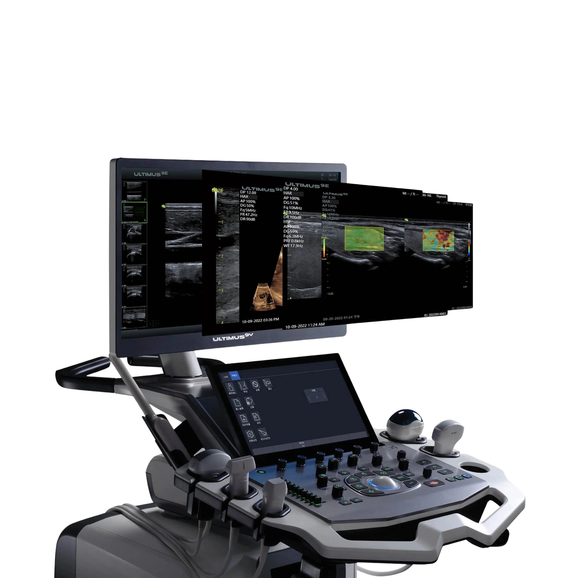 Ecógrafo VINNO ULTIMUS 9V VINNO