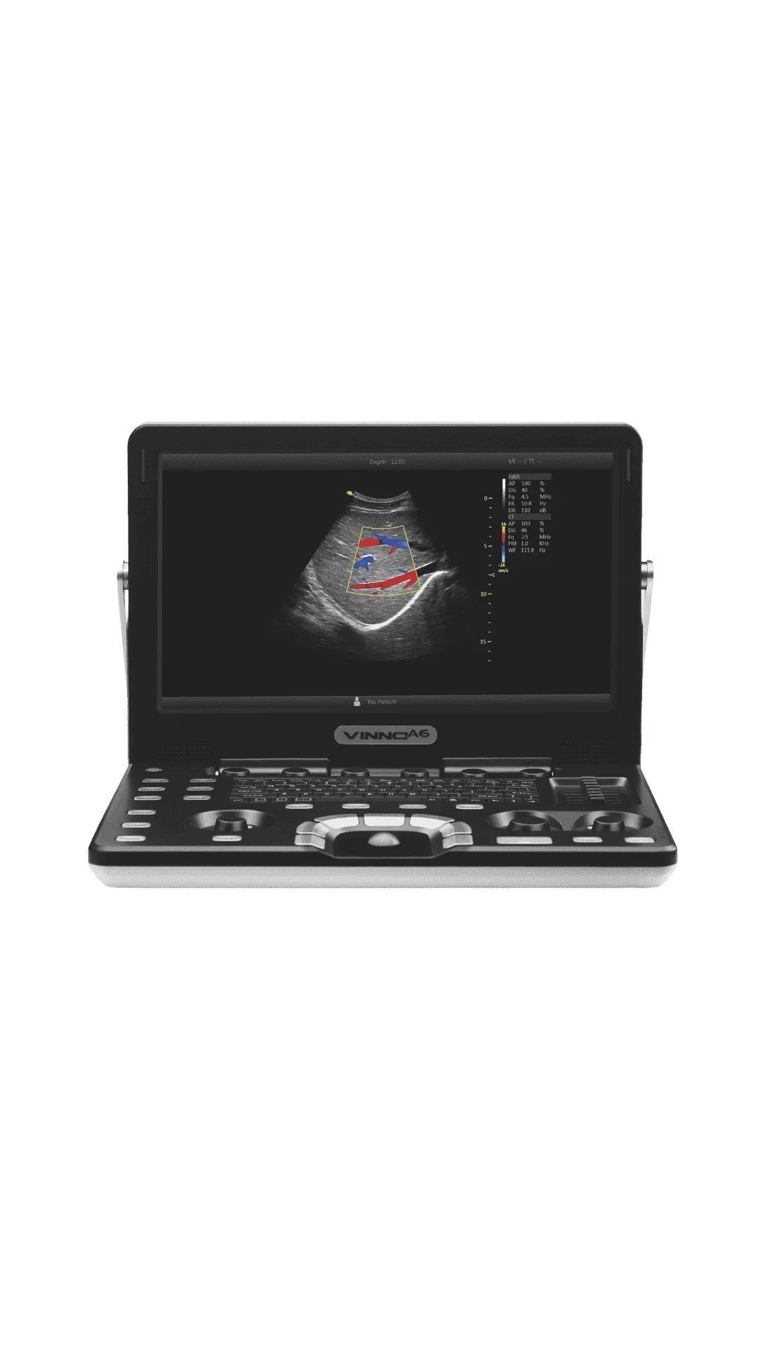 Ecógrafo Portátil VINNO A6