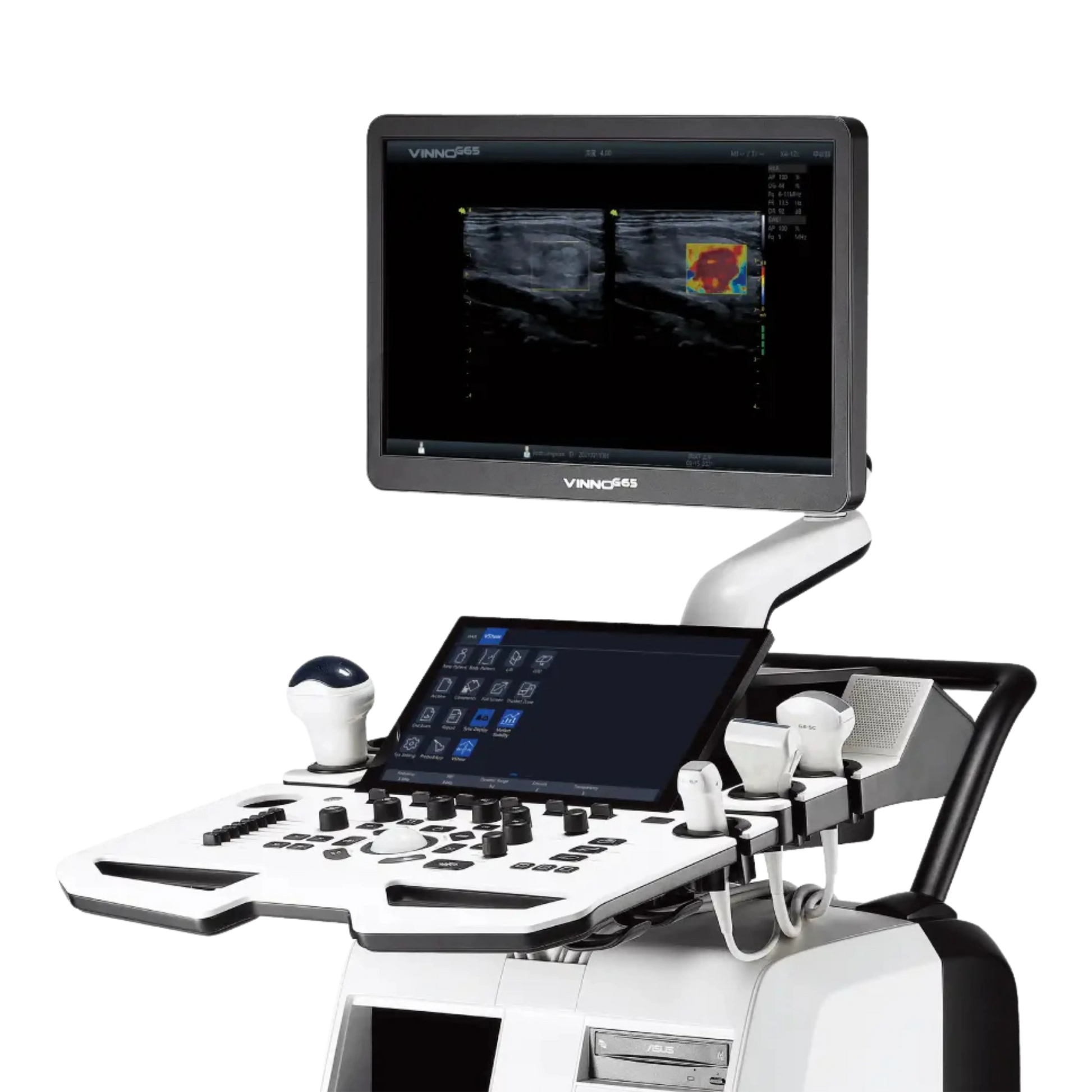 Ecógrafo VINNO G65 VINNO